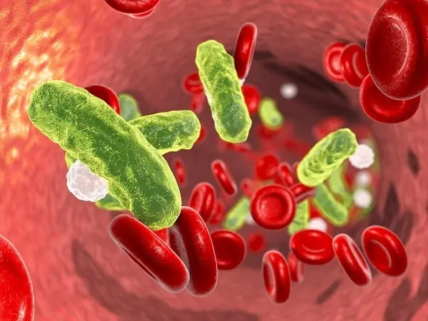virus