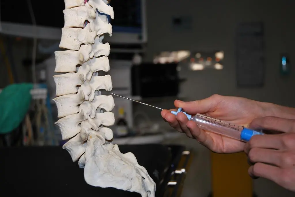 Anestesia epidural