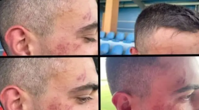 Agresión a un jugador del Villaralbo