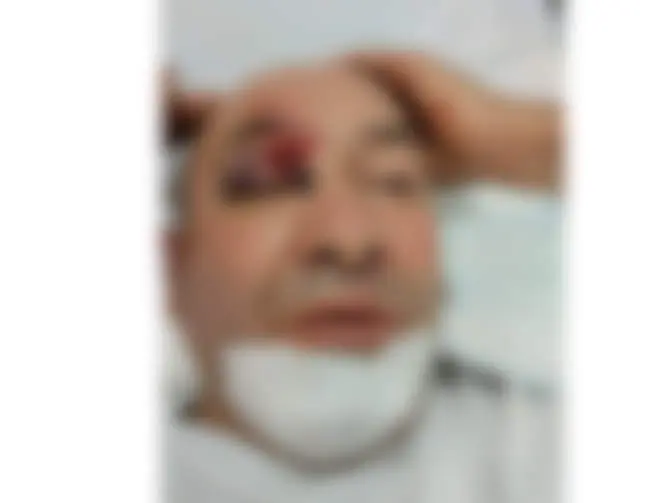 Lesiones que presenta la víctima de una agresión en Castrogonzalo