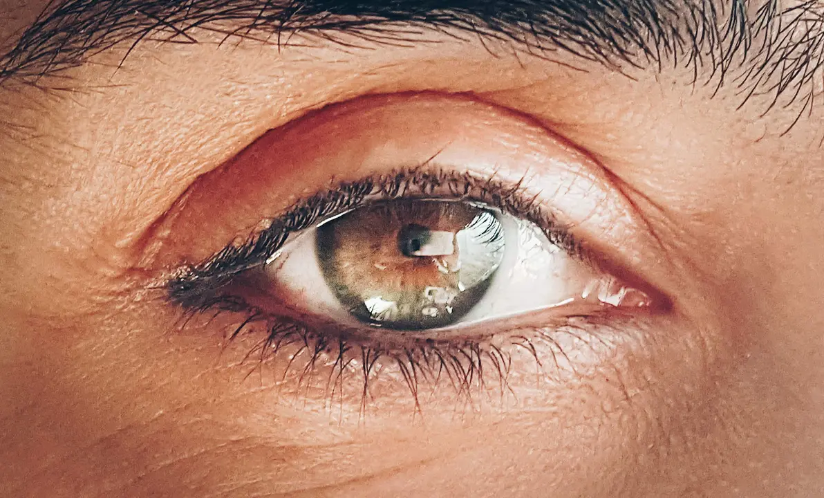 Ojo