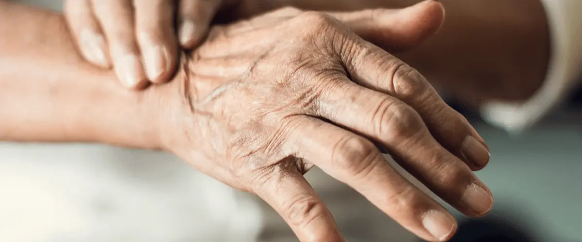 parkinson