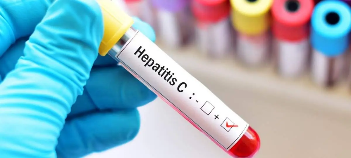 Hepatitis C