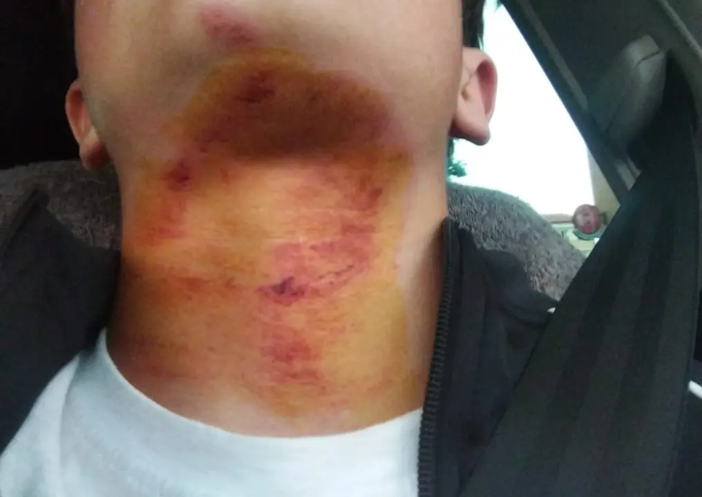 Menor herido