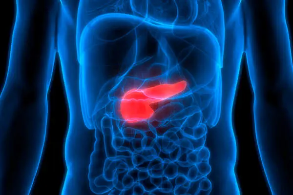 cáncer de páncreas
