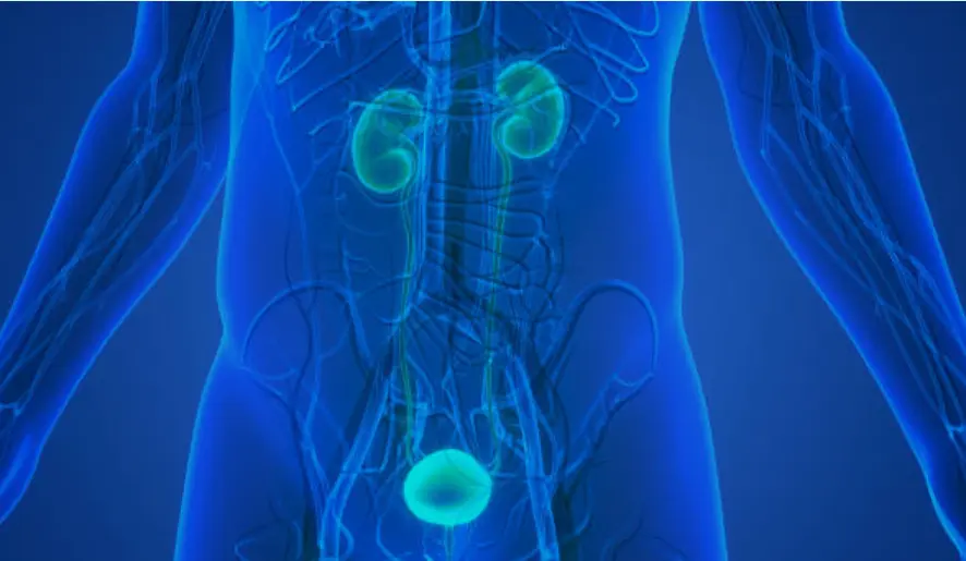 Cáncer de próstata. Fotografía de archivo
