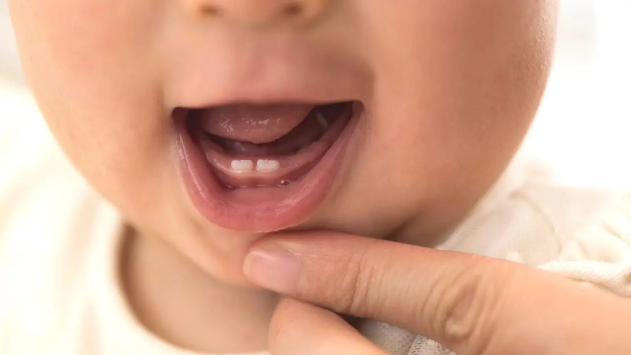 dientes de leche. Imagen ade asistencia especializada