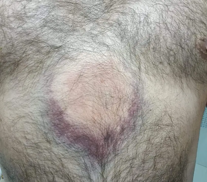 agricultor afectado por las pelotas de goma. IMAGEN CEDIDA