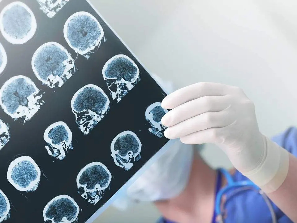 Radiografía cerebral