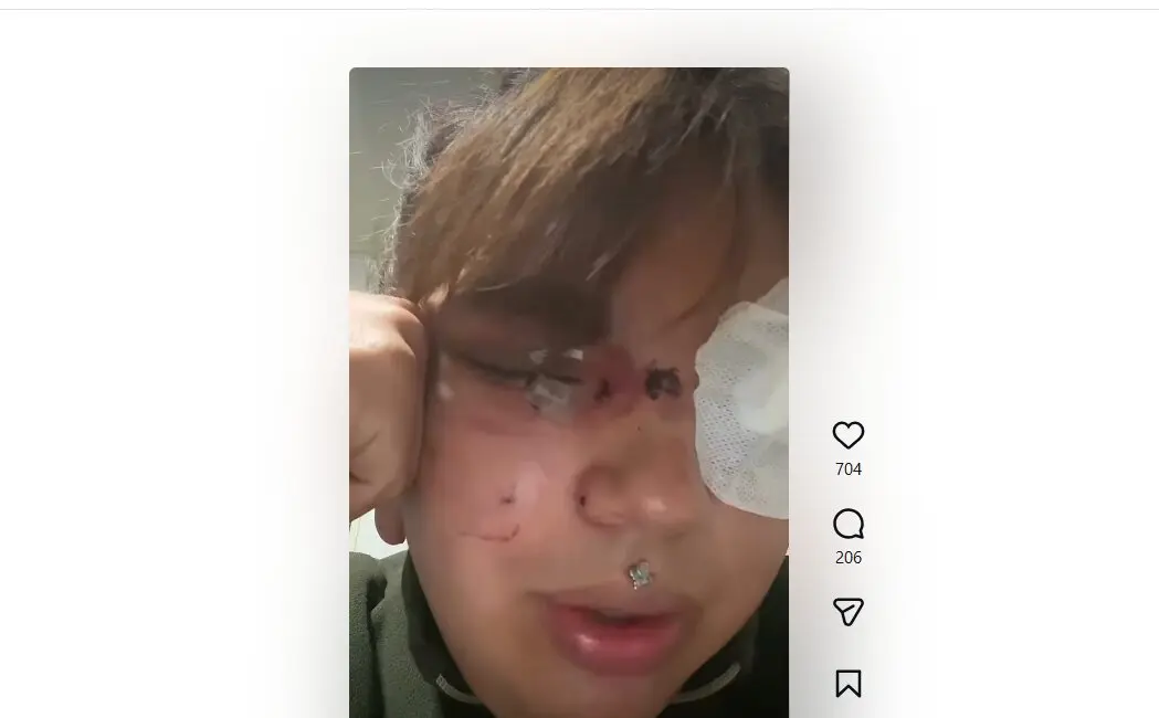 agresi&oacute;n a una mujer Bianca Fern&aacute;ndez