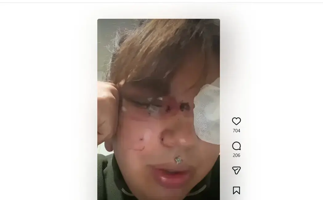 Bianca Fern&aacute;ndez muestra las secuelas tras la agresi&oacute;n