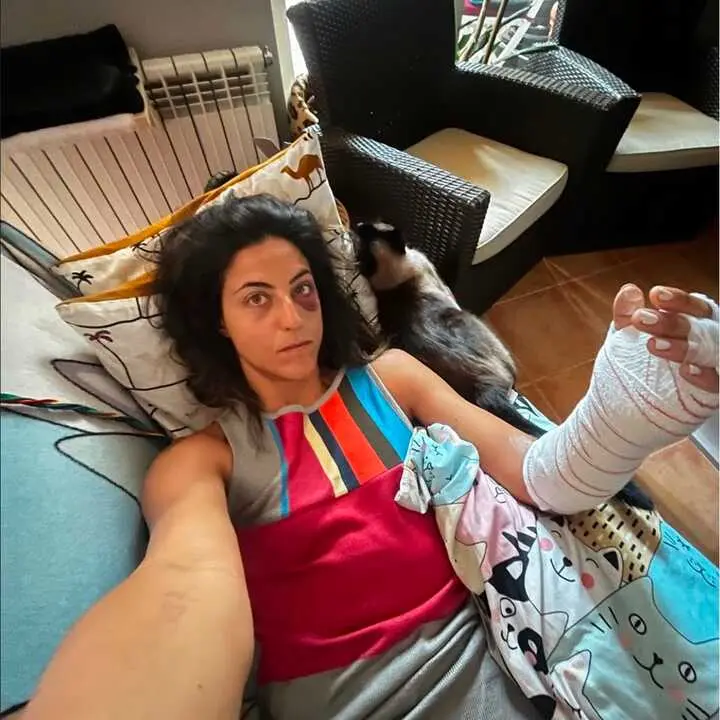 Sara Garcia Lesi&oacute;n - imagenes @sarita98garcia