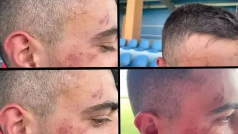 Agresión a un jugador del Villaralbo