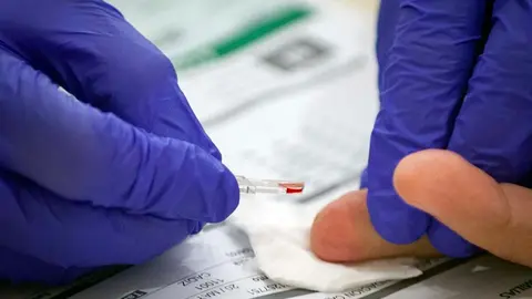 Foto archivo prueba niveles de hemoglobina