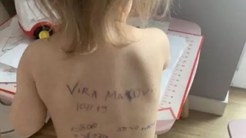 Vera con sus datos apuntados en la espalda