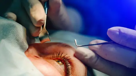 The operation on the eye. Cataract surgery. Vision correction.