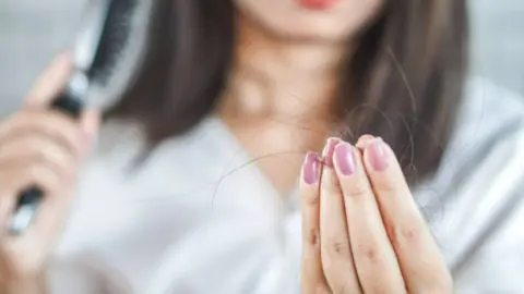 Caída cabello. Fotografía de archivo