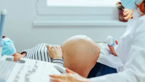 Ecografía. Fotografía de archivo