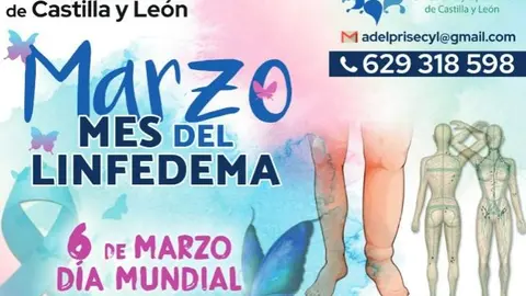 Día Internacional del Linfedema