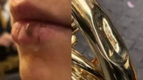 Daños caída instrumentos