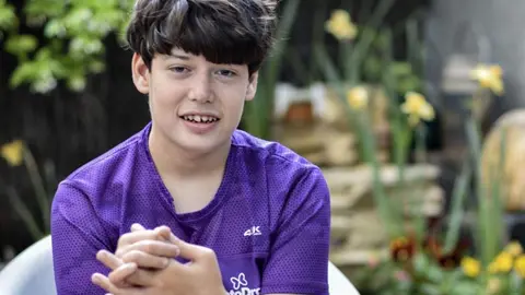 Adulto con síndrome de Dravet