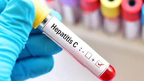 Hepatitis C