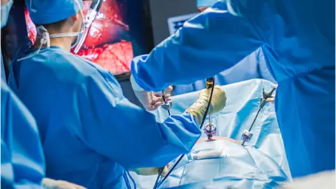 Cirugía por laparoscopia. Fotografía de archivo