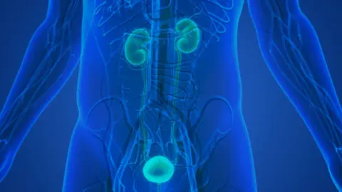 Cáncer de próstata. Fotografía de archivo