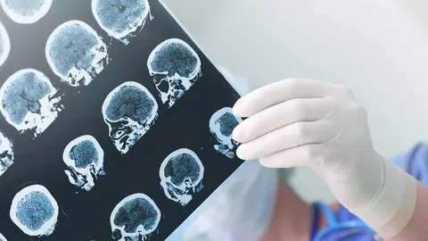 Radiografía cerebral