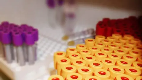 Material para la extracción de sangre