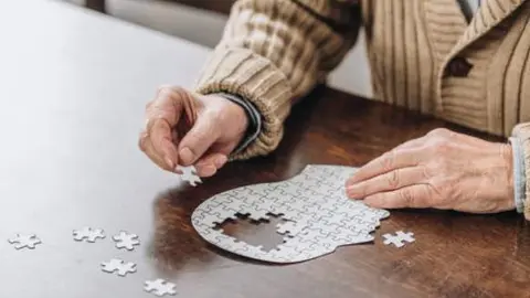 Enfermedad neurogdegenerativa. Fotografía de archivo