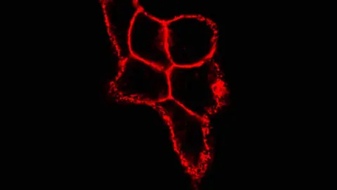 Asociación Contra el Cancer Zamora y Toro Estudio
