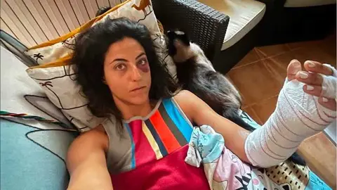 Sara Garcia Lesi&oacute;n - imagenes @sarita98garcia