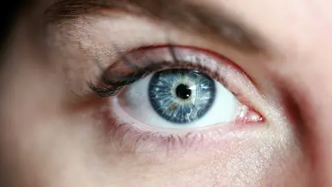 alexandergrey-eye-3805227