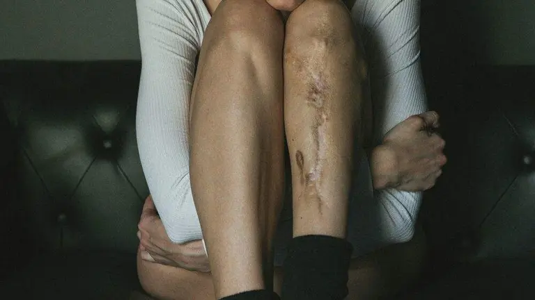 La joven fermosellana Andrea Ruano. Fotografía: Álvaro Rodríguez