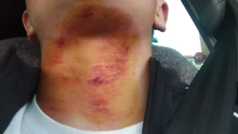 Menor herido