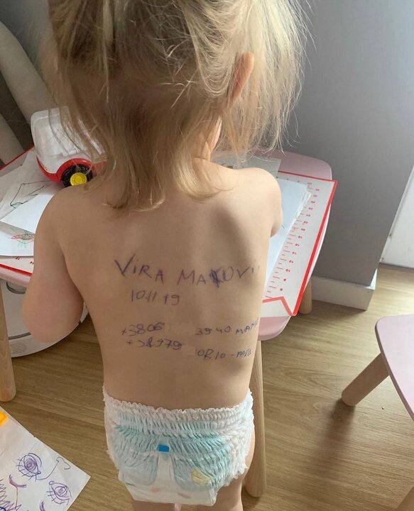niña marcada